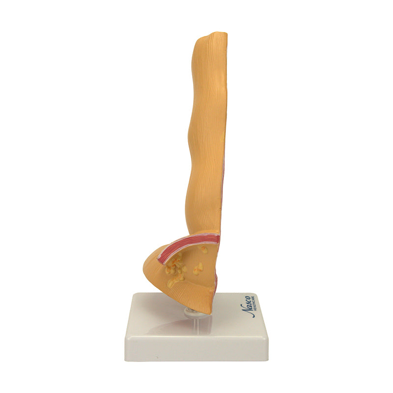 गैलरी व्यूअर में छवि लोड करें, अन्नप्रणाली रोग मॉडल, 5X बढ़ा हुआ [SKU: MG22729]
