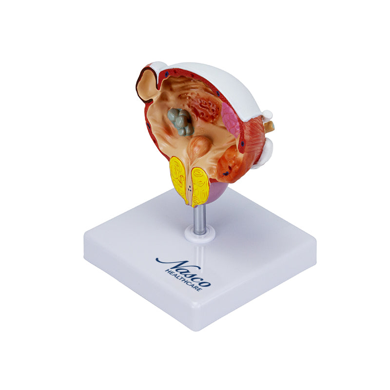 Carica immagine in Galleria Viewer, Modello di Malattie della Vescica e della Prostata [SKU: MG22730]
