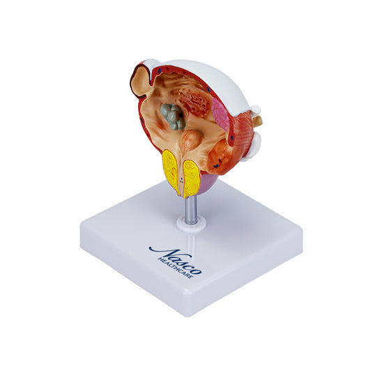 Modello di Malattie della Vescica e della Prostata [SKU: MG22730]