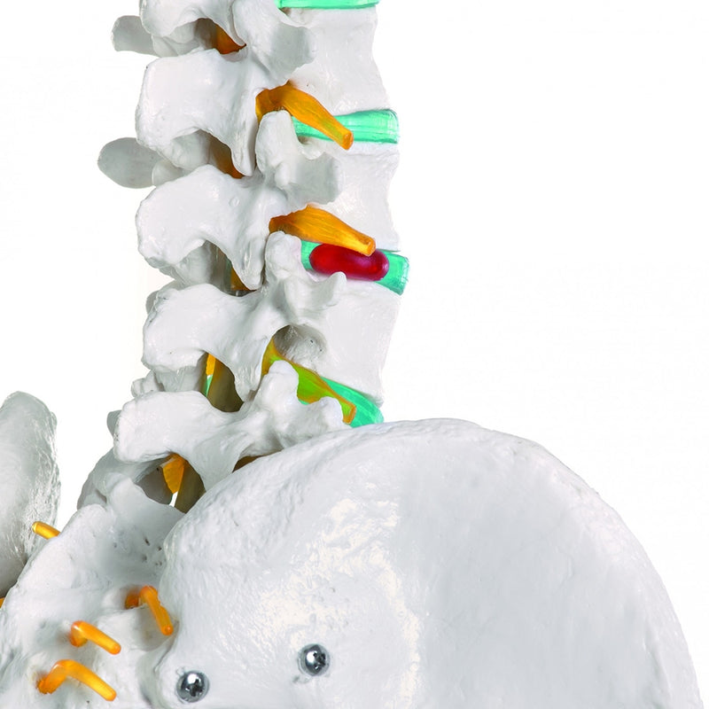 Load image into Gallery viewer, Adult Skeleton Mounted on Stand with Casters
