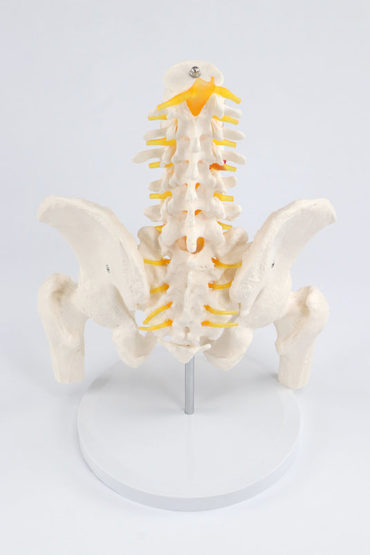 Model Panggul Perempuan dengan Kepala Femur [SKU: MG22963]