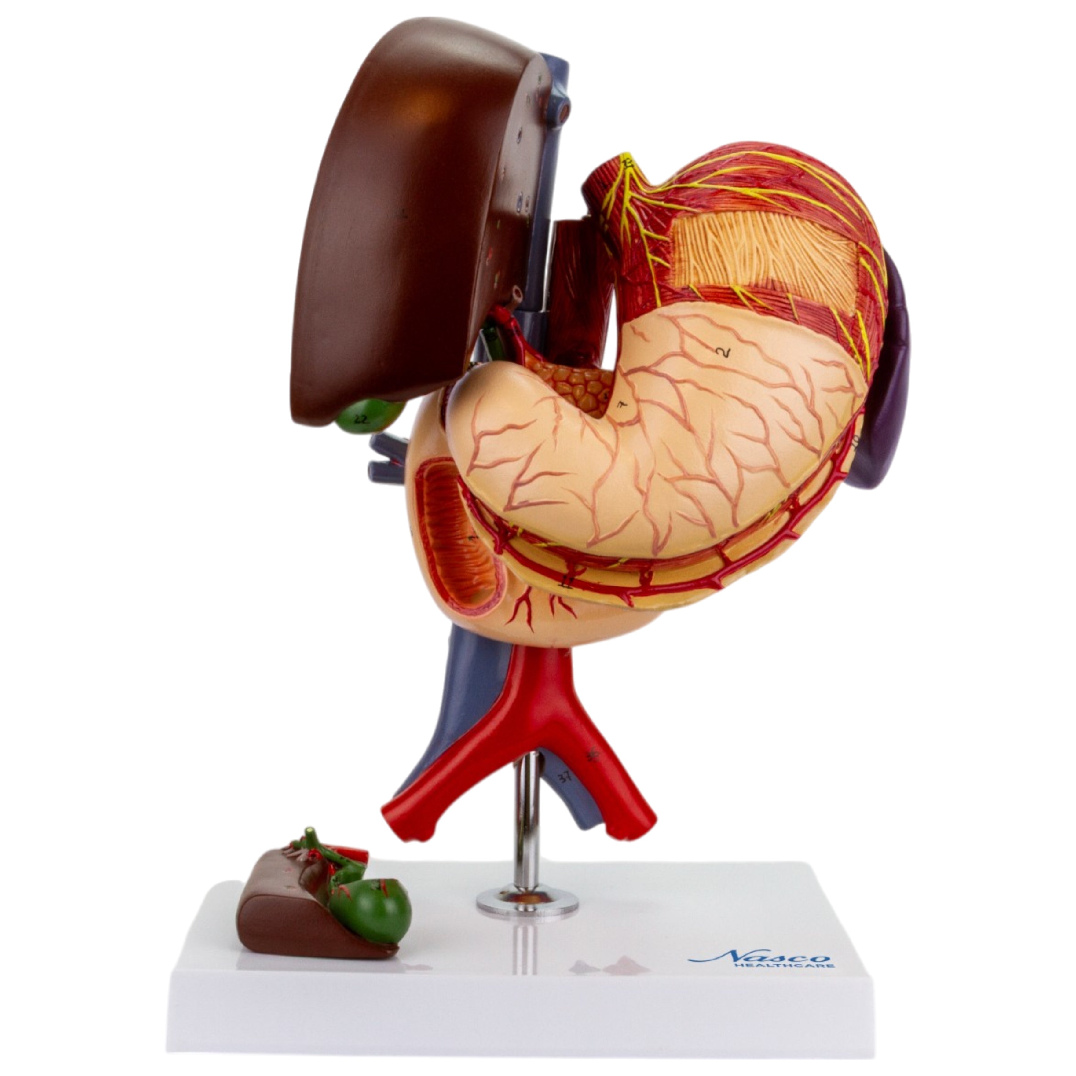 Stomach Model, 6 Parts – Nasco Healthcare
