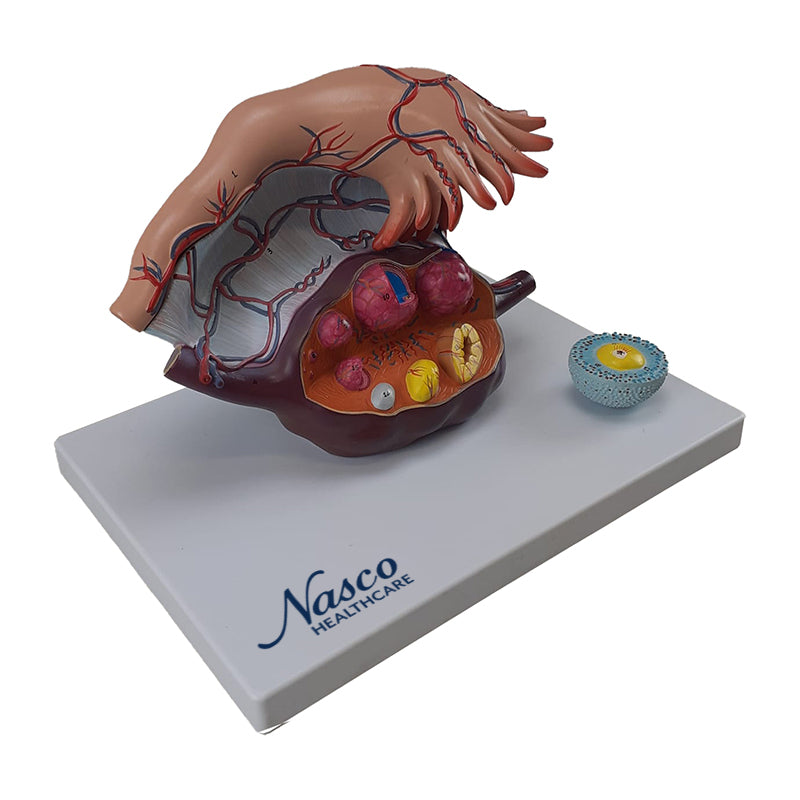 Load image into Gallery viewer, Ovary Model, 5X Enlarged, 2 Parts
