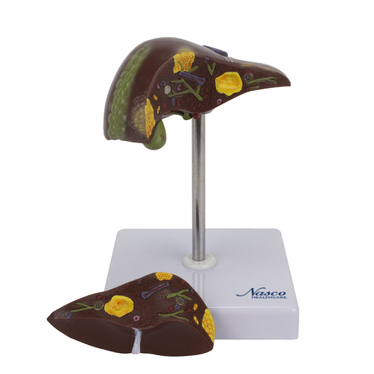 Liver Section with Pathology Model, 2 Parts