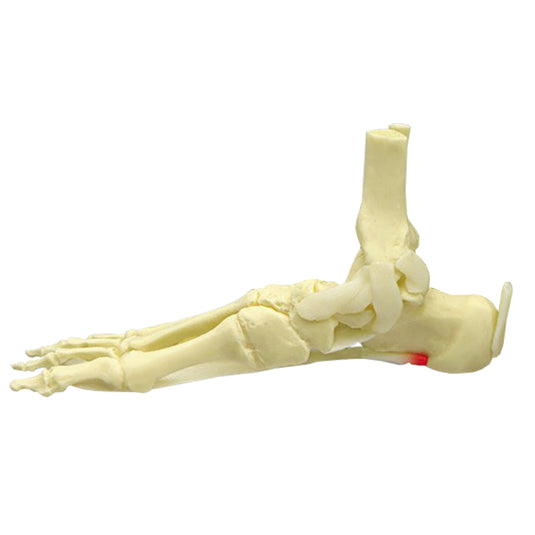 Modelo de Pé e Tornozelo com Fascite Plantar [SKU: MG29758]