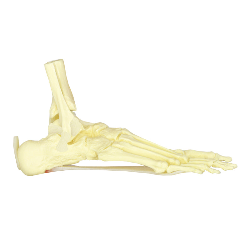 Carregue imagem no visualizador da galeriaModelo de Pé e Tornozelo com Fascite Plantar [SKU: MG29758]
