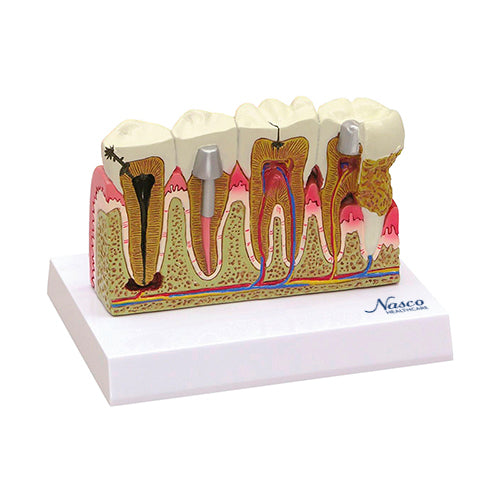 牙齿模型 [SKU: MG29771]