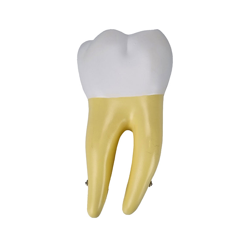 Load image into Gallery viewer, Lower Molar Tooth Model, 2 Parts
