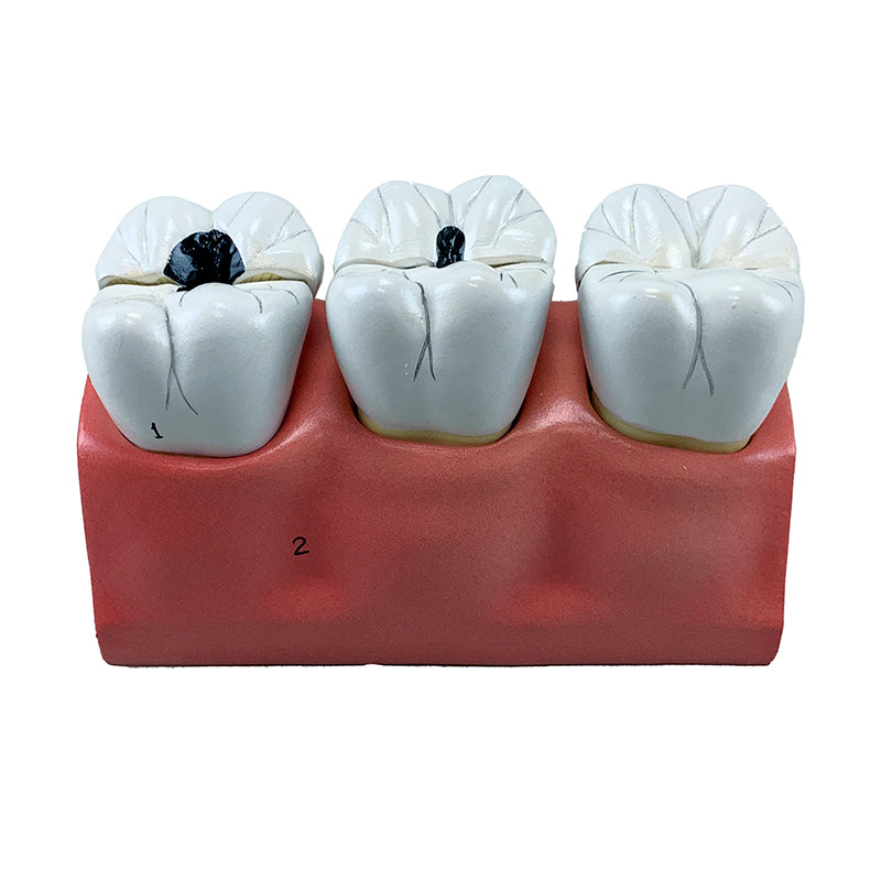 Cargue la imagen en el visor de la galería, Modelo de Morfología Dental, 4X Ampliado, 7 Piezas [SKU: MG29837]
