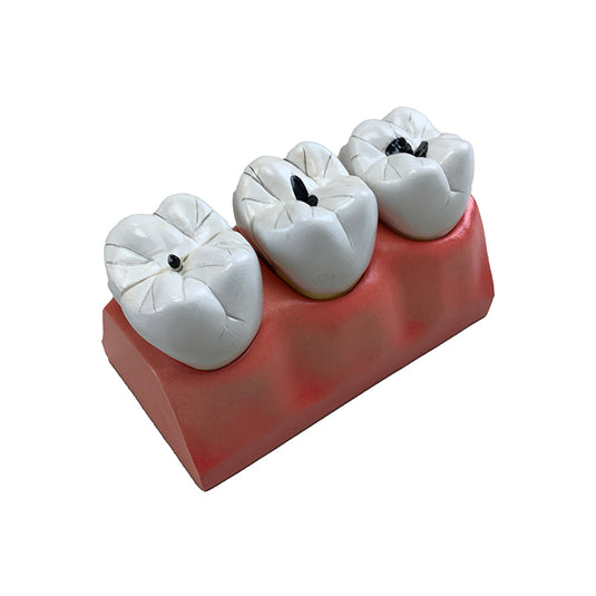 Modelo de Morfología Dental, 4X Ampliado, 7 Piezas [SKU: MG29837]