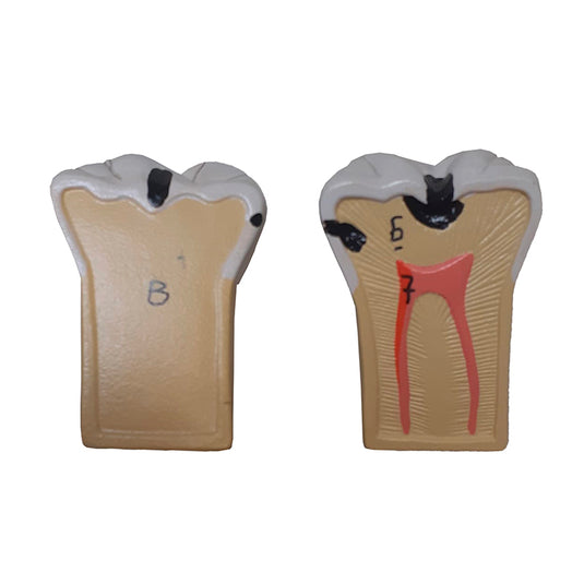 Modelo de Morfología Dental, 4X Ampliado, 7 Piezas [SKU: MG29837]