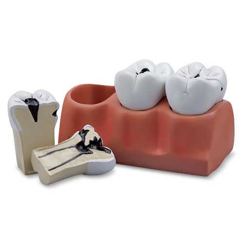 Cargue la imagen en el visor de la galería, Modelo de Morfología Dental, 4X Ampliado, 7 Piezas [SKU: MG29837]
