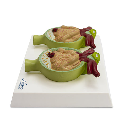 Nephrone mit Pathologiemodell, 300X vergrößert [SKU: MG29879]