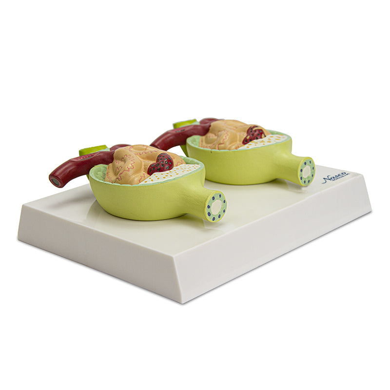 Laden Sie das Bild in Galerie -Viewer, Nephrone mit Pathologiemodell, 300X vergrößert [SKU: MG29879]
