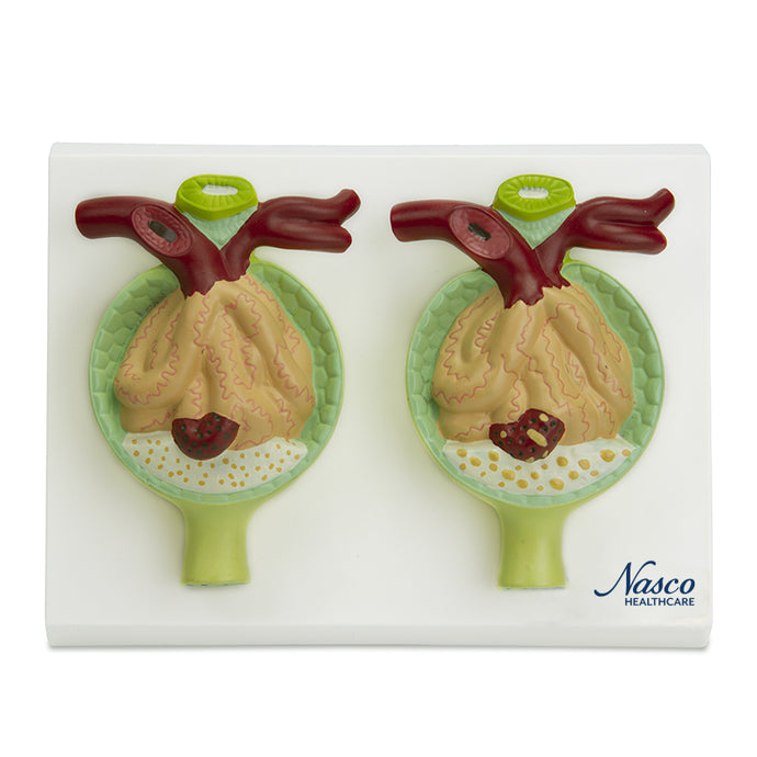 Nephrone mit Pathologiemodell, 300X vergrößert [SKU: MG29879]