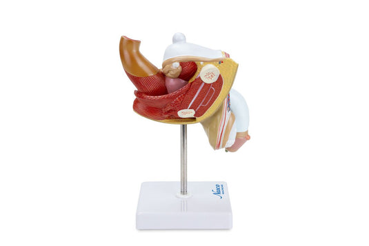 Mannelijk Genitaal Orgaan met Pathologie Model, 2 delen [SKU: MG29949]