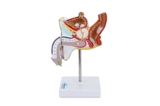 Mannelijk Genitaal Orgaan met Pathologie Model, 2 delen [SKU: MG29949]