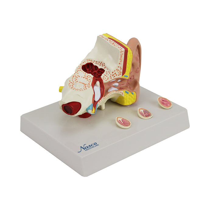 Oído con Patología Modek, 1.5X Ampliado [SKU: MG29985]