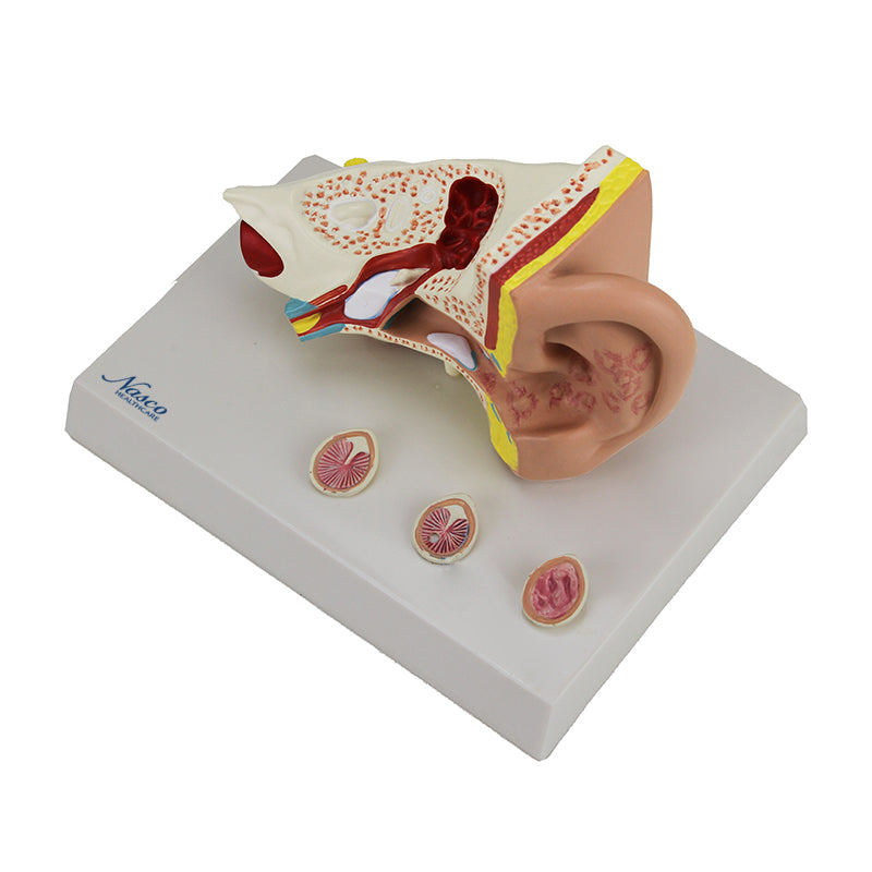 Cargue la imagen en el visor de la galería, Oído con Patología Modek, 1.5X Ampliado [SKU: MG29985]
