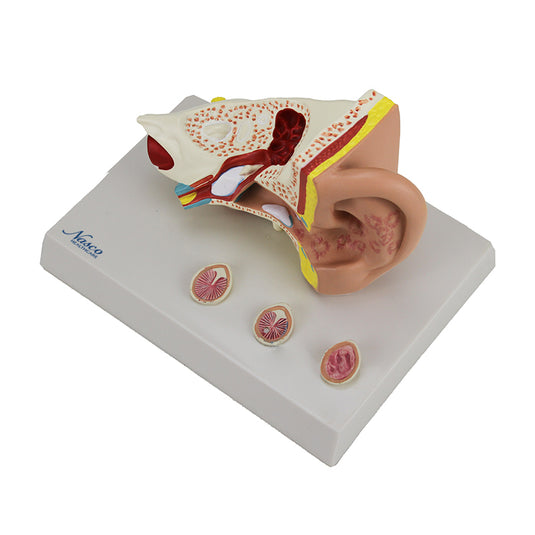 Oído con Patología Modek, 1.5X Ampliado [SKU: MG29985]