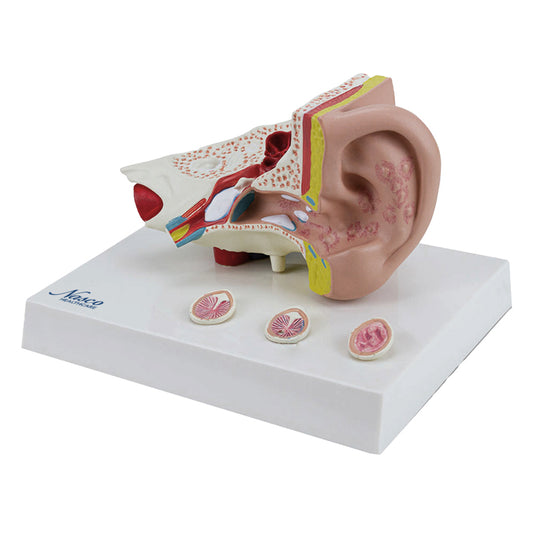 Oído con Patología Modek, 1.5X Ampliado [SKU: MG29985]