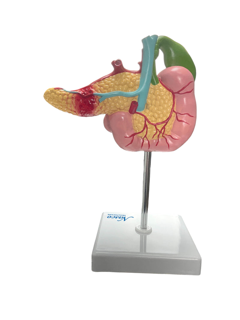 Load image into Gallery viewer, Pancreas, Duodenum, &amp; Gallbladder with Pathology Model
