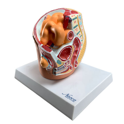 Pelvis with Indirect Inguinal Hernia Model, Half-Size
