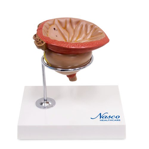 확대된 전립선 모델, 4개 부분 [SKU: MG30752]