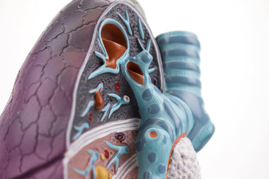 Polmone con Modello Patologico, Ingrandito 1.5X  [SKU: MG30885]