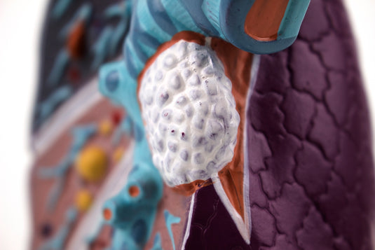 Long met Pathologie Model, 1.5X Vergroot  [SKU: MG30885]