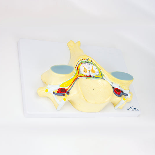 5ª Vértebra Cervical, 7X Ampliada [SKU: MG30911]