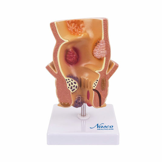 Model Wasir, Diperbesar 5X [SKU: MG31005]