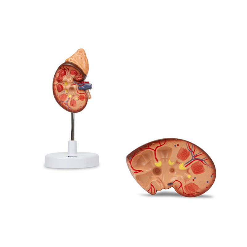 Load image into Gallery viewer, Kidney with Adrenal Gland Model, 1.5X Enlarged, 2 Parts
