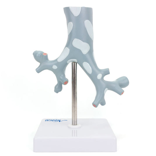 Секция бронхиального дерева с моделью патологии, увеличенная в 10 раз [SKU: MG31098]