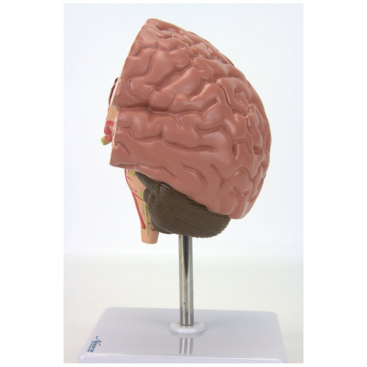 Bagian Otak dengan Model Patologi [SKU: MG31100]