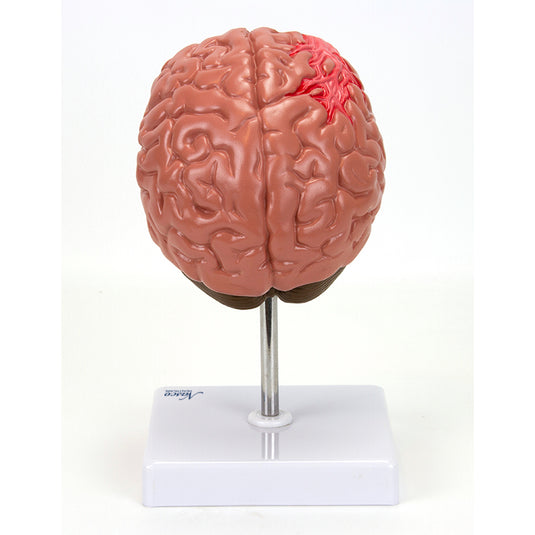 Bagian Otak dengan Model Patologi [SKU: MG31100]