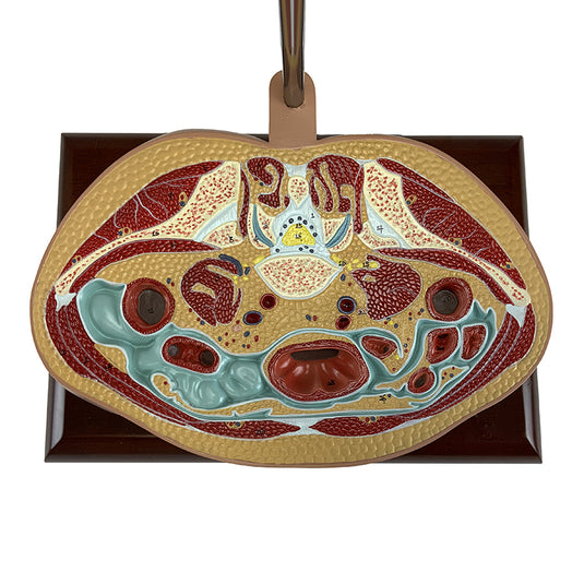 Torso Section Model, 24 Discs