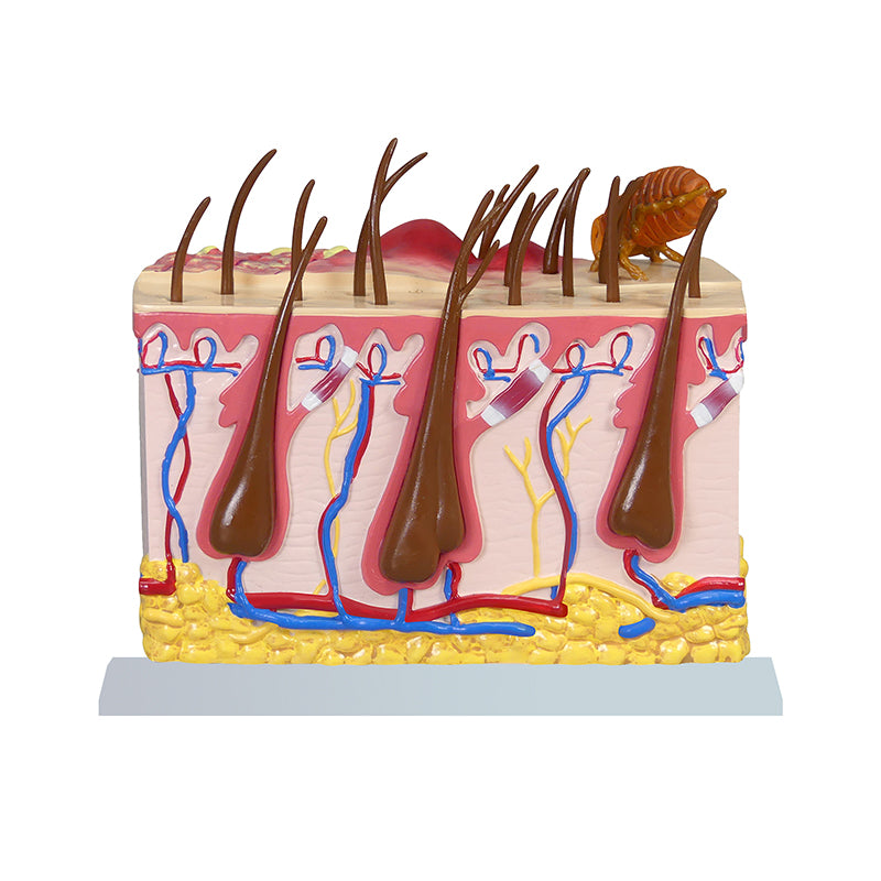 Laden Sie das Bild in Galerie -Viewer, Normaler &amp; Pathologischer Hautabschnittsmodell für Hunde, Vergrößert [SKU: MG34920]
