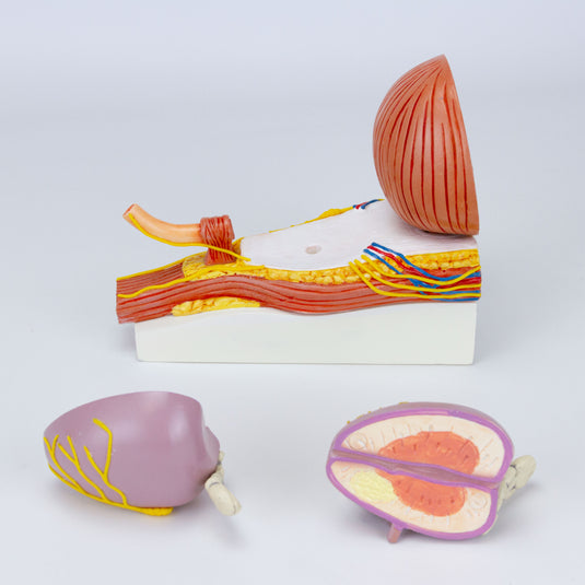 Prostate Scale Modle Prostate with Pathology Model – Nasco Healthcare