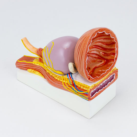 Prostate Scale Model Prostate with Pathology Model – Nasco Healthcare