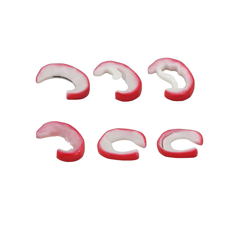 將圖像載入到圖庫檢視器中， Meniscus Knee with 6 Tears Model
