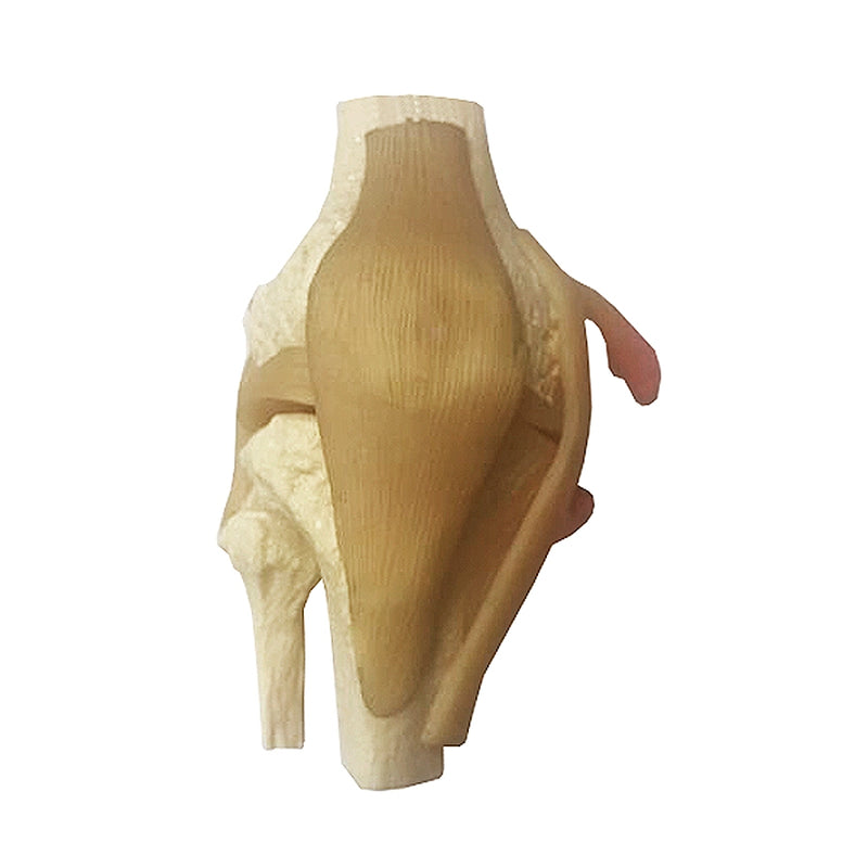 將圖像載入到圖庫檢視器中， Meniscus Knee with 6 Tears Model

