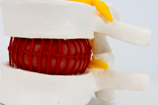 Hernien-Diskus-Demonstrationsmodell [SKU: MG35510]
