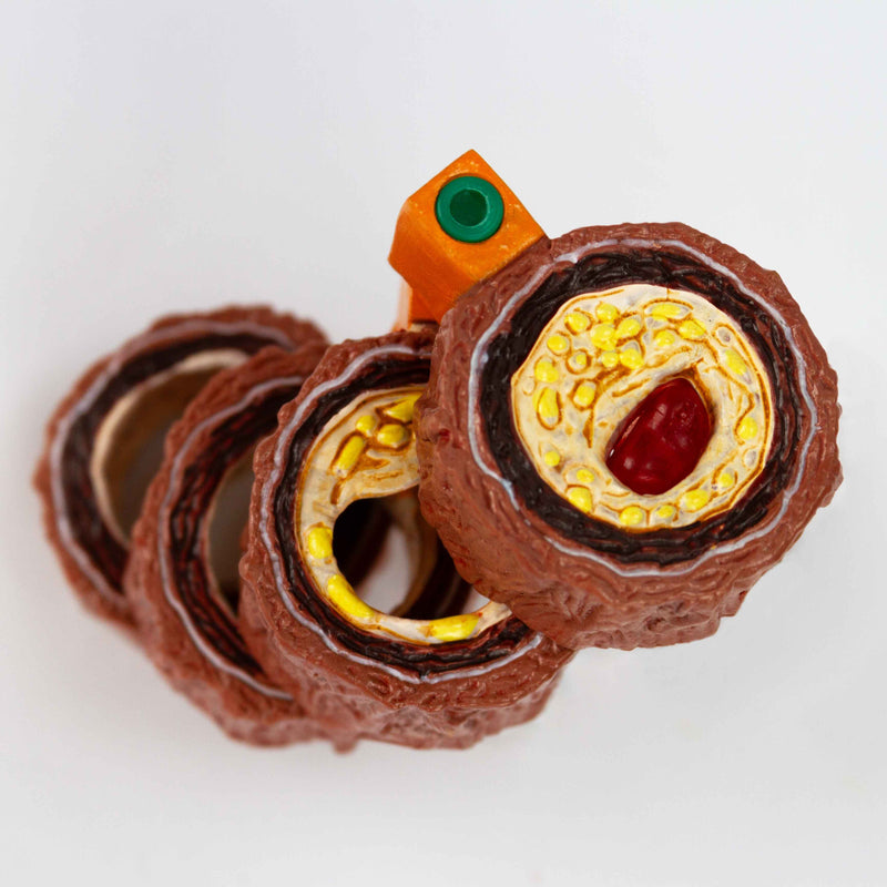 Load image into Gallery viewer, Arteriosclerosis Model, 4 Stages
