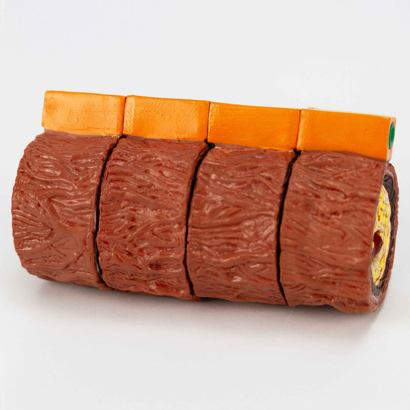 Load image into Gallery viewer, Arteriosclerosis Model, 4 Stages
