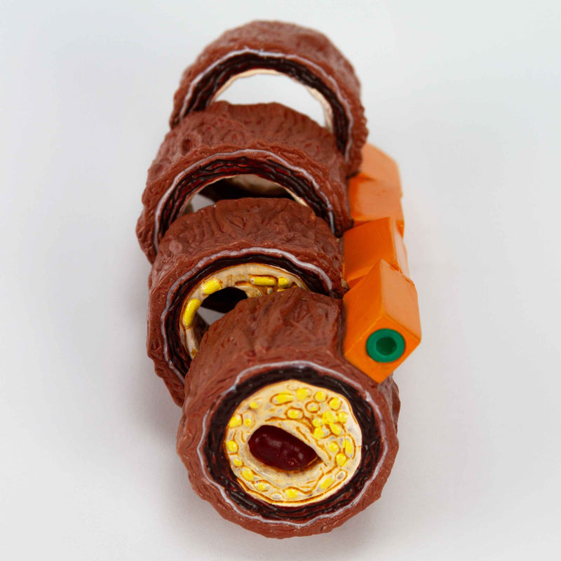Load image into Gallery viewer, Arteriosclerosis Model, 4 Stages
