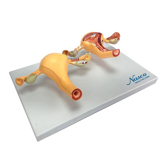 Healthy & Pathological Uterus Model