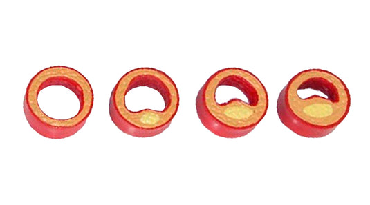 Heart with Arteriosclerosis Model