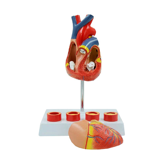 Heart with Arteriosclerosis Model