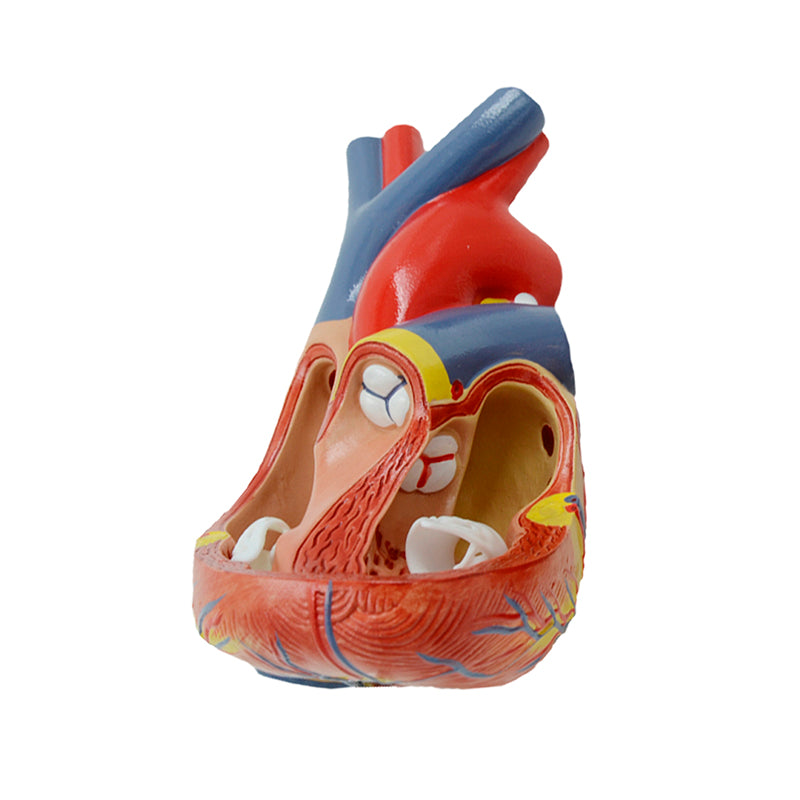 Load image into Gallery viewer, Heart with Arteriosclerosis Model
